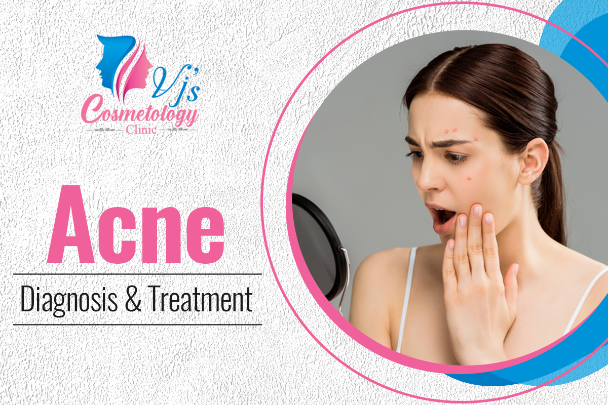 Advanced Acne Scars and Pimple Marks Removal Treatments