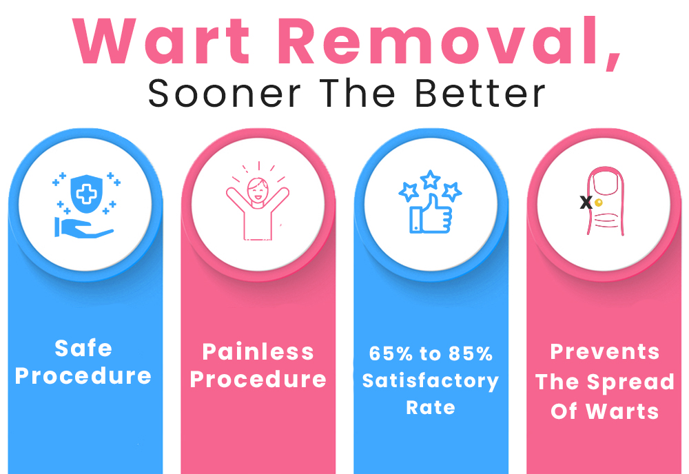 Wart-Removal,-Sooner-The-Better