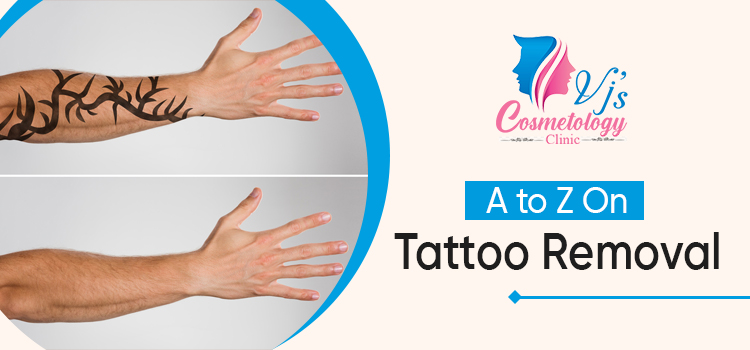 A-to-Z-On-Tattoo-Removal-vjs-cosmetology