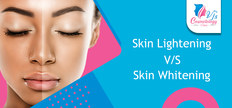  What should you choose between skin lightening and skin whitening?