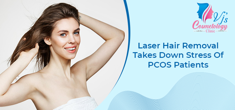 Laser Hair Removal Takes Down Stress Of PCOS Patients