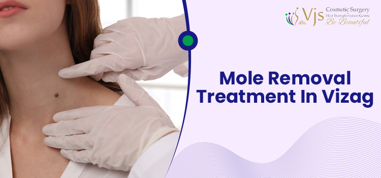 Mole Removal Treatment In Vizag
