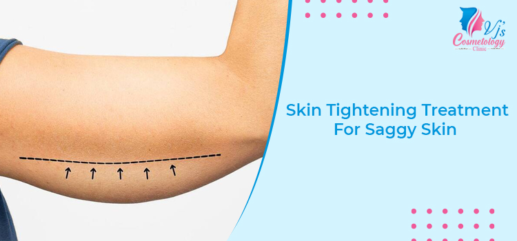 Skin Tightening Treatment For Saggy Skin