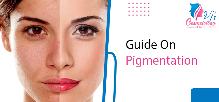  Everything you need to know about skin pigmentation treatment