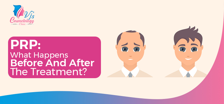  What are the before and after effects of PRP treatment for hair loss?