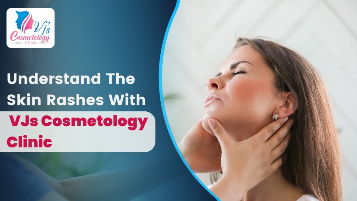 Understand The Skin Rashes With VJs Cosmetology Clinic